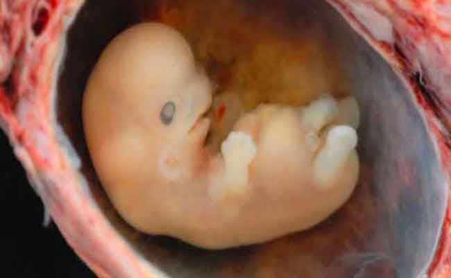 في أي مرحلة يتم اكتشاف الحمل خارج الرحم...؟