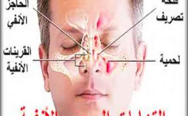 لعلاج الجيوب الانفية بالملح فوائد كثيرة...!