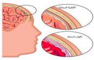 لماذا يتعرّض الأطفال الرضّع إلى التهاب السحايا...؟