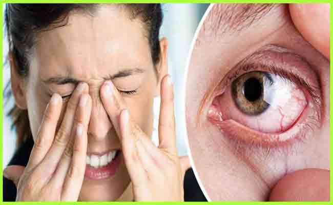 6 أسباب شائعة للإصابة بجفاف العين...!