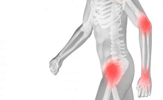هل يوجد علاجات فعّالة لهشاشة العظام...؟