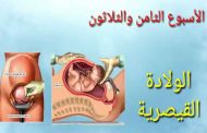 في أيّ أسبوع تتمّ الولادة القيصريّة الثالثة...؟