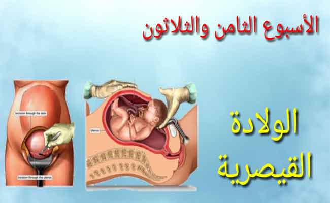 في أيّ أسبوع تتمّ الولادة القيصريّة الثالثة...؟