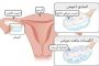 قوات إيرانية تحتجز سفينة قرب جزر الإماراتية المحتلة