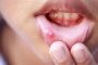 ماذا تعرفون عن جراحة تجميل عظام الوجه...؟