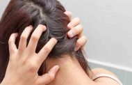 كيف يمكن الحفاظ على فروة رأس صحيّة...؟