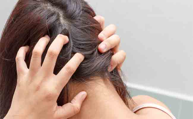 كيف يمكن الحفاظ على فروة رأس صحيّة...؟