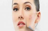 كيف يمكنك إخفاء شعر الوجه بالمكياج؟ اليك الخطوات...