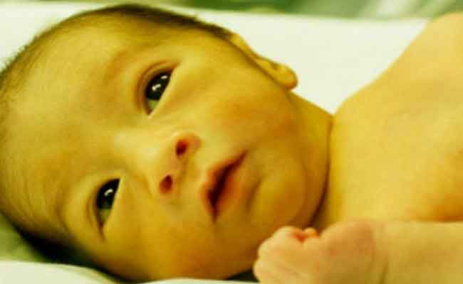 متى تشكّل الصفراء خطراً على صحة الرضيع؟...
