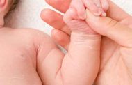 هل تقشّر جلد طفلكِ الرضيع طبيعي؟...