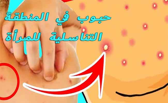 هذه الأسباب تؤدي إلى ظهور حبوب في المهبل!...