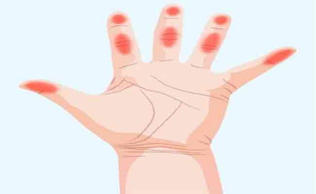 لماذا تعانون من رعشة اليد عند التوتر...؟