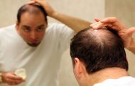 ما هي العلاجات المتاحة أمامك في حال كنت تعاني من الصلع...؟