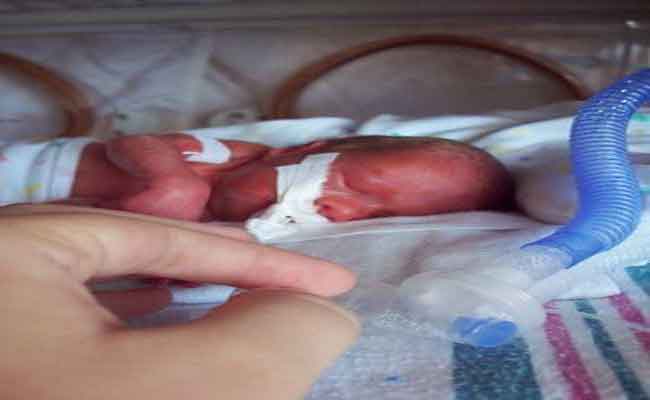 هل نزيف الاوعية الدموية تحت الجلد علامة على حالة طبية خطيرة؟...