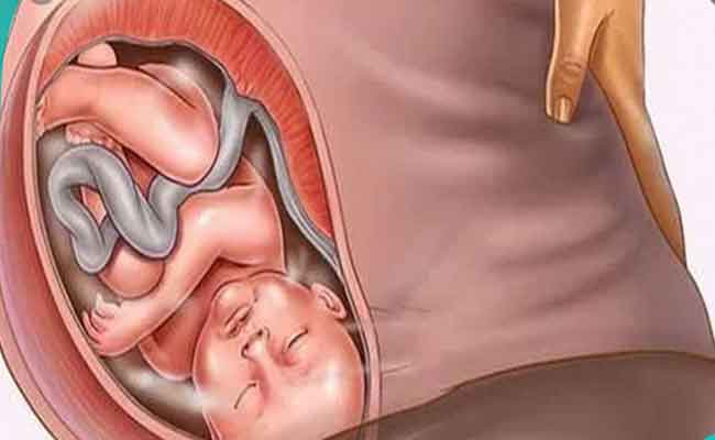 هذه هي التغيّرات التي تطرأ على رأس الجنين أثناء الولادة...
