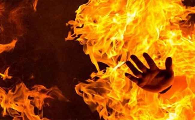 مراهق يشعل النار في جسمه داخل متوسطة بالجلفة...
