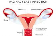 للوقاية من فطريات المهبل...6 نصائح وخطوات ضرورية!