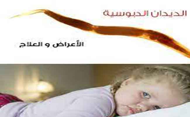 الديدان الدبوسية عند الرضع...هل تدعو للقلق؟