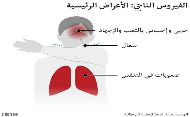 اعراض يمكن ان تعانوا منها خلال الاصابة الثانية بفيروس كورونا...