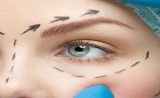 ما الذي تحتاجون إلى معرفته حول شد العين بالليزر؟