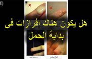 ما هي دلالات نزول إفرازات بنية بعد تأخر الدورة الشهرية؟