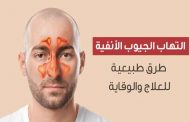 ما هي العلاجات المتاحة لإلتهاب الجيوب الانفية؟
