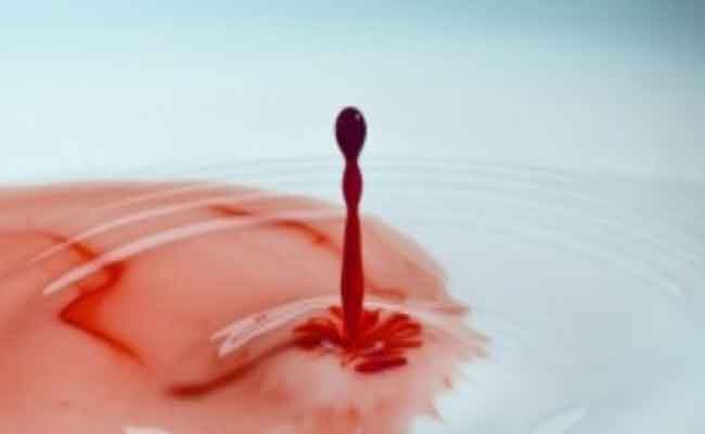 هل نزول الدم فقط علامة من علامات الاجهاض؟