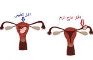ما هو الحمل خارج الرحم؟