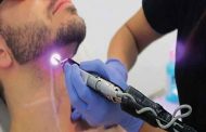 لماذا يعتبر الليزر من أفضل التقنيات للتخلص من الشعر؟