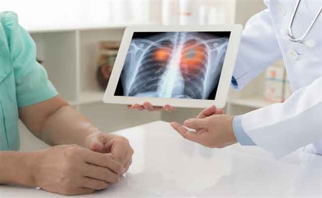 فحوصات مهمة يُنصح بها بعد التعافي من كورونا