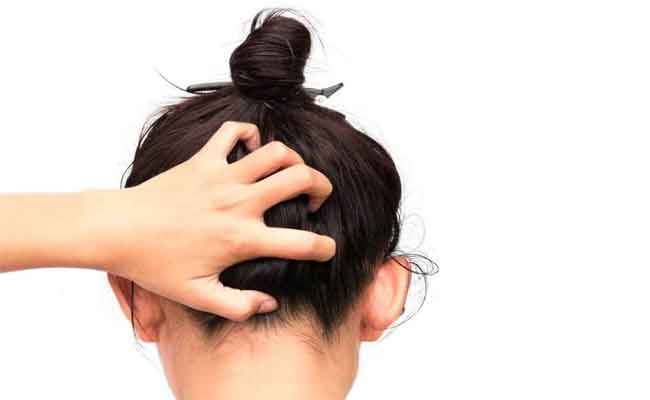 ماسكات طبيعية تساعد على ترطيب الشعر والتخلص من الجفاف!