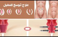 هل المهبل الواسع من المشاكل الشائعة بعد الولادة؟