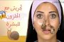 هل تعرفون ما هي فوائد زهرة الآلام الشائعة؟