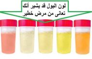تغير لون البول عند الرجل...هل هناك ما يدعو للقلق؟