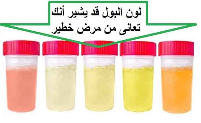 تغير لون البول عند الرجل...هل هناك ما يدعو للقلق؟