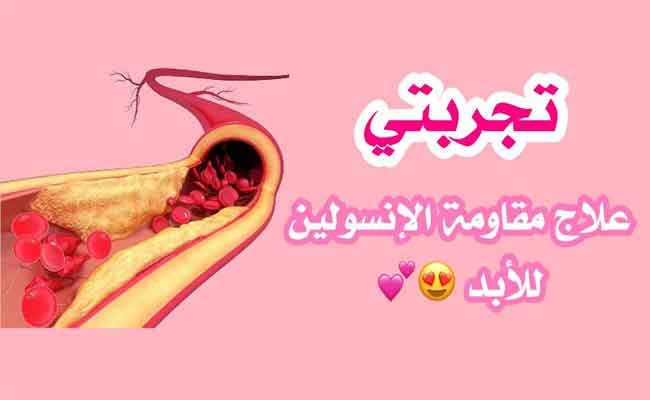 ما هي شروط عمل رجيم مقاومة الانسولين؟ وما مدى فعّاليته؟