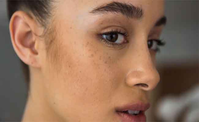 أسباب كثيرة ومختلفة تؤدي لتلف البشرة...اليك أبرزها!