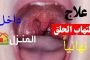 قلّة احترام المراهق لأهله...خطوات فعّالة لمواجهة هذه المشكلة!