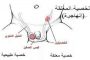 هل الخلايا الجذعية علاج واعد لمرض السكري؟