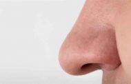 6 أعراض تدلّ على فشل عملية الأنف...