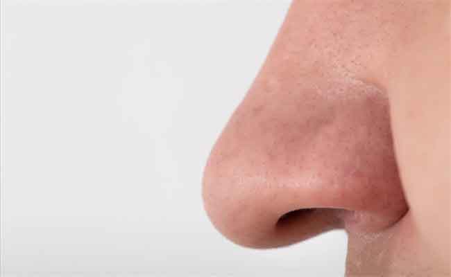 6 أعراض تدلّ على فشل عملية الأنف...