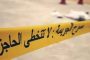 شد الرقبة عملية جراحية تخلّصك من الترهلات...كيف تتمّ؟