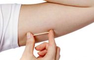 ماذا تعرفين عن وسيلة منع الحمل المزروعة؟
