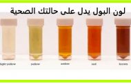 على ماذا يدلّ لون البول عند الأطفال؟