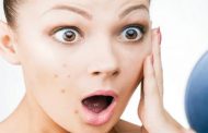 5 خطوات تحمي بشرتك من الحبوب المزعجة!
