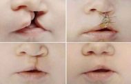 ما هي انواع عمليات التجميل الترميمية؟
