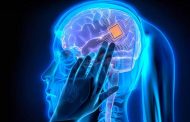 ابتكار شرائح ذكية للدماغ...
