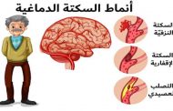 7 أشياء يمكنكم القيام بها للوقاية من السكتة الدماغية...