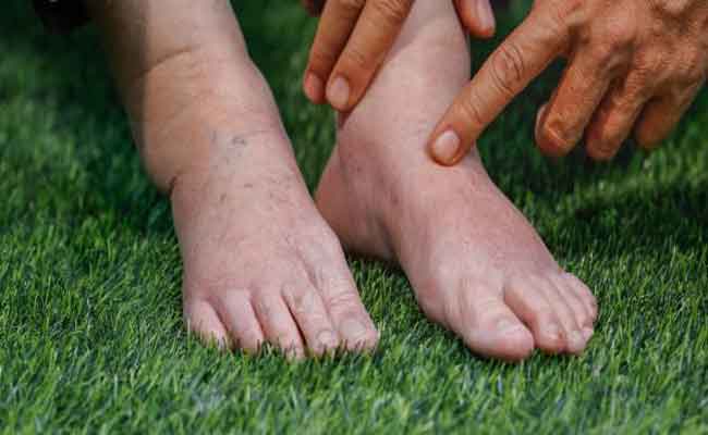 ما هي الأعراض التي تدلّ على ارتفاع نسبة الأملاح في جسمكم؟