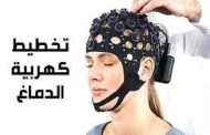 ابتكار تكنولوجيا تتيح للمرضى إجراء تخطيط للدماغ دون طبيب...